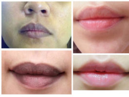 8 cách trị thâm môi tại nhà hiệu quả